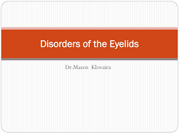 ppt disorders of the eyelids