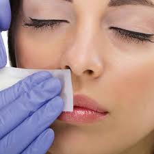 upper lip waxing sharone skin specialist
