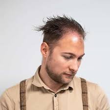 Finding the optimal hairstyle with thinning hair is critical to looking your best. 75 Perfect Receding Hairline Haircuts Hide The Bad Hairline