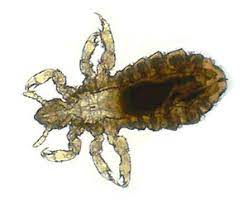 head body lice kill and get rid of