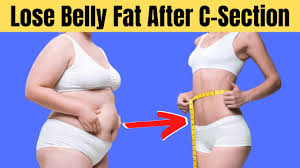 how to lose hanging belly fat after c