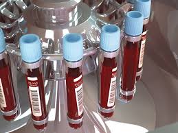 blood typing purpose procedure and risks
