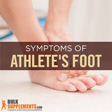 tinea pedis athlete s foot causes