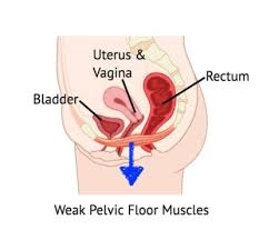 pelvic pain causes and treatment west