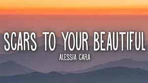 alessia cara scars to your beautiful