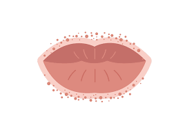 mouth what causes a lip rash