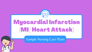 Cardiac care plans