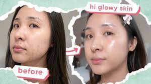 korean skincare routine for acne