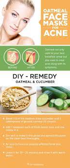 Whip up one of these and say bye, felicia to pesky blemishes. Pin On Acne