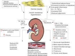 Acute renal failure occurs when renal function suddenly declines to very low levels, so that little or no urine is formed, and the substances, including even water, that the kidney normally eliminates are. Metabolic Risk Factors And Renal Disease Kidney International