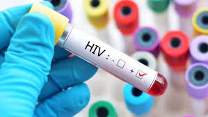 best hiv doctor in delhi
