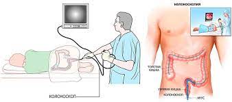 Maybe you would like to learn more about one of these? Kolonoskopiya V Klinike Viva Diagnostika Zabolevanij Kishechnika