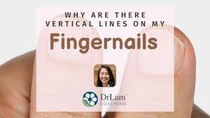 vertical lines on fingernails may