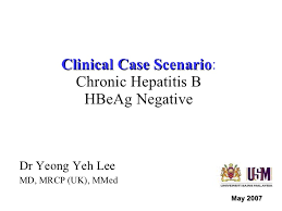 If you have been exposed to the virus in the past few days, emergency treatment if you have had the infection for more than 6 months (chronic hepatitis b), you may be offered treatment with medicines that can keep the virus. Case Studies Hbeag Negative Chronic Hepatitis B