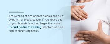A breast lump or thickening that feels different from the surrounding tissue change in the size, shape or appearance of a breast changes to the skin over the breast, such as dimpling What Are The Signs And Symptoms Of Breast Cancer Envision Radiology