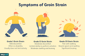 Groin muscles pain is felt in the form of sports hernia which is due to the sudden pulling of muscle. Diagnosing And Treating Groin Pulls