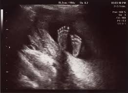 Ob ultraschallwellen dem ungeborenen schaden können, ist nicht abschließend geklärt. 19 Ssw Schwangerschaftswoche Alle Infos Tipps 9monate De