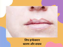 lips infection treatment in hindi