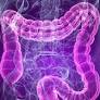intestino colon irritable de www.bbc.com