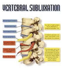Vertebral Subluxation Nerve Chart Carroll Chiropractic
