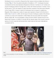 Monkeypox is a viral zoonosis (a virus transmitted to humans from animals) with symptoms similar to those seen in the past in smallpox patients, although it. This Is Not A Photo Of A Nigerian Man Diagnosed With Monkeypox In Singapore In May 2019 It S An Old Image Of A Congo Child With The Disease Fact Check