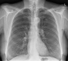 Therefore, knowing the basics and pathologies in the ed setting is very important. Presenting An X Ray