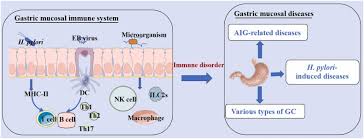 gastric immune homeostasis imbalance