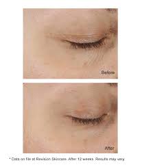 revision skincare dej eye cream
