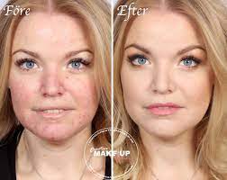 make up skin with rosacea tips
