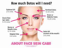 Botox Injection Sites Face Diagram Botox Cosmetic