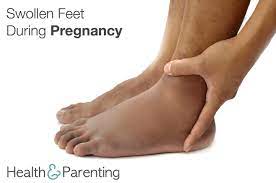 swollen feet during pregnancy philips