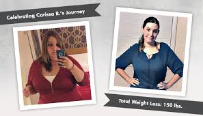 pcos with carissa r losing 150 pounds