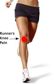 what is runner s knee signs symptoms