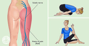 poses to relieve sciatica pain