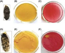 colonies on lb and macconkey agar