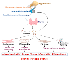 thyroid disease and atrial fibrillation