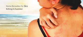 home remes for skin itching in summer