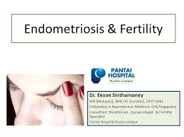 Homeopathy treatment for endometriosis at welling homeopathy clinics, india offer specially formulated homeopathy medicines for endometriosis. Endometriosis Fertility Ppt Video Online Download