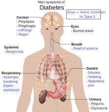 Diabetes Mellitus Type   Schematic Diagram         parts    