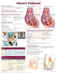 Heart Failure Chart Poster Laminated