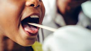 itchy tongue causes symptoms and