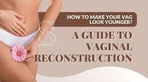 How to Make Your Vag Look younger? A Guide to Vaginal Reconstruction -  Salameh Plastic Surgery Center