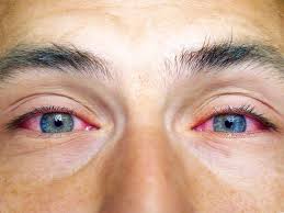 visible red or blue eye veins