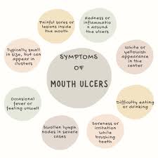 home remes for treating mouth ulcers