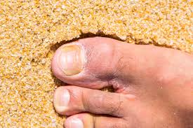 top 6 warning signs of toenail fungus