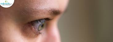ophthalmology thyroid eye disease