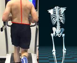 low back pain while running