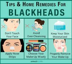 how to get rid of blackheads at home