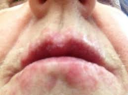 fat lips sixth in line