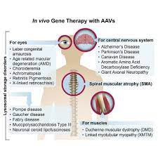 Current Clinical Applications of In Vivo Gene Therapy with AAVs: Molecular  Therapy